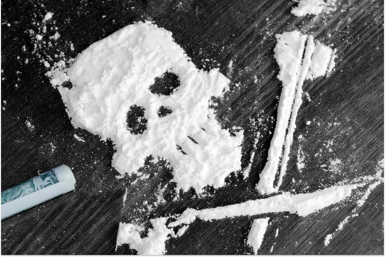 Cover image for What Does Cocaine Do to Your Brain?