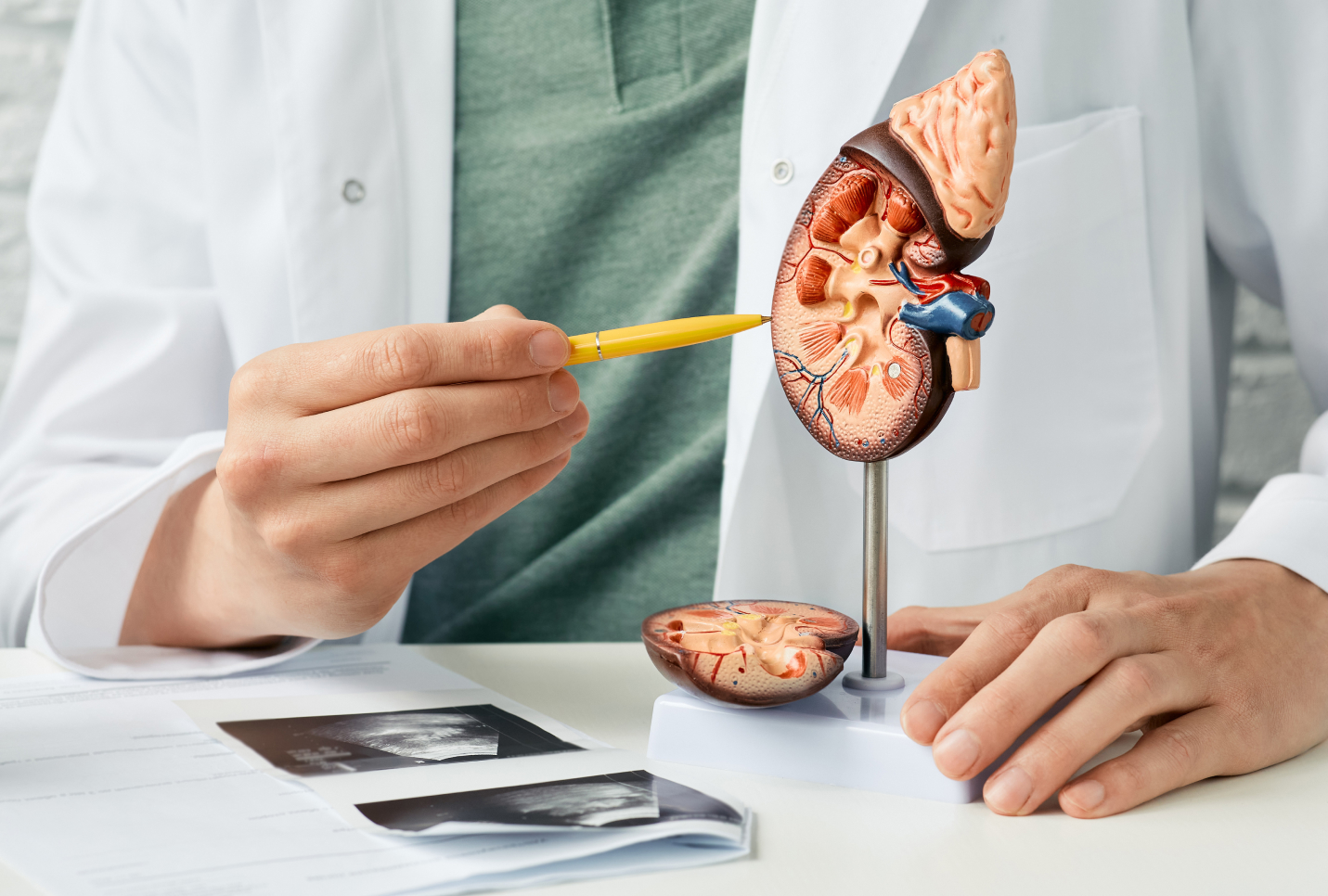 Cover image for Early Warning Signs of Kidney Damage From Alcohol